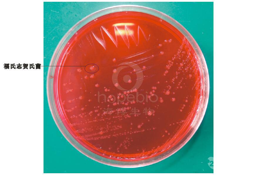 法国科玛嘉 志贺氏菌显色培养基